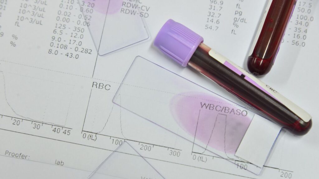 Biometría Hemática Completa