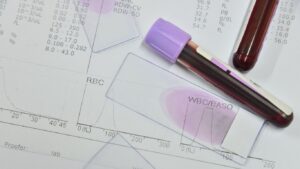 Biometría Hemática Completa