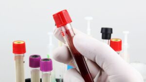 Química Sanguínea 35 elementos