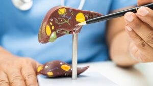 Pruebas de Función Hepática